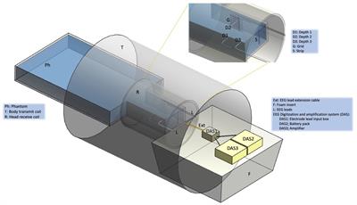 Temperature Measurements in the Vicinity of Human Intracranial EEG Electrodes Exposed to Body-Coil RF for MRI at 1.5T